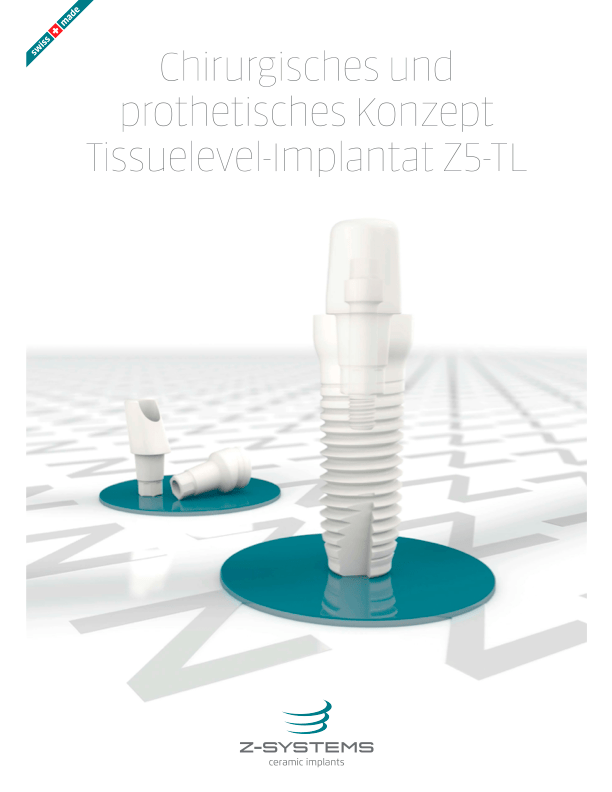Surgical-Prosthetic Concept-Z5-TL